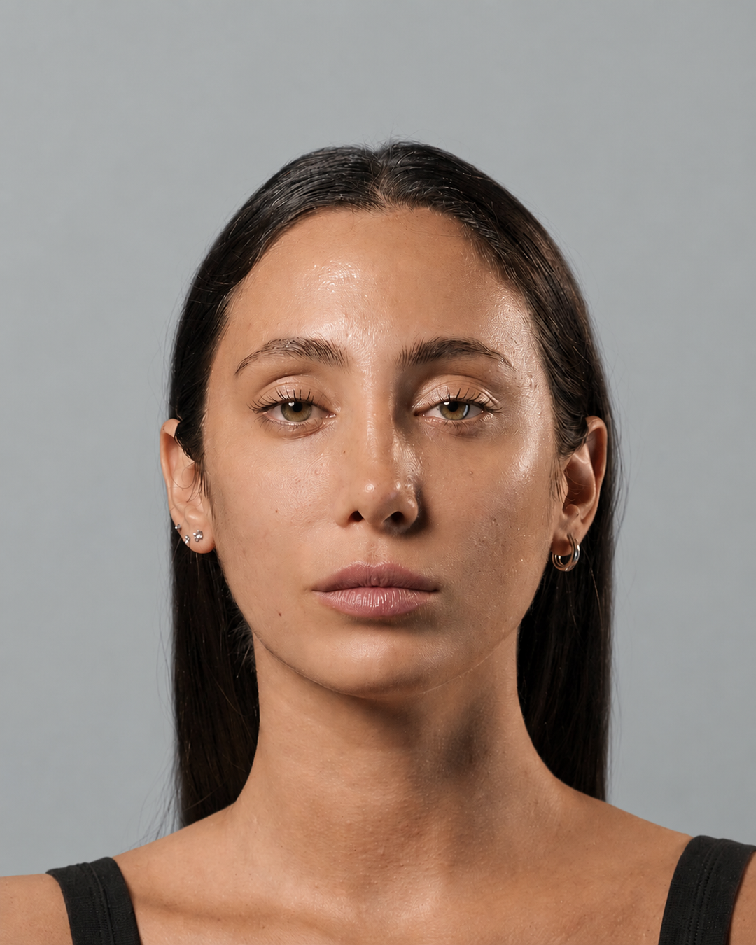 Paziente FaceLine® , prima del protocollo