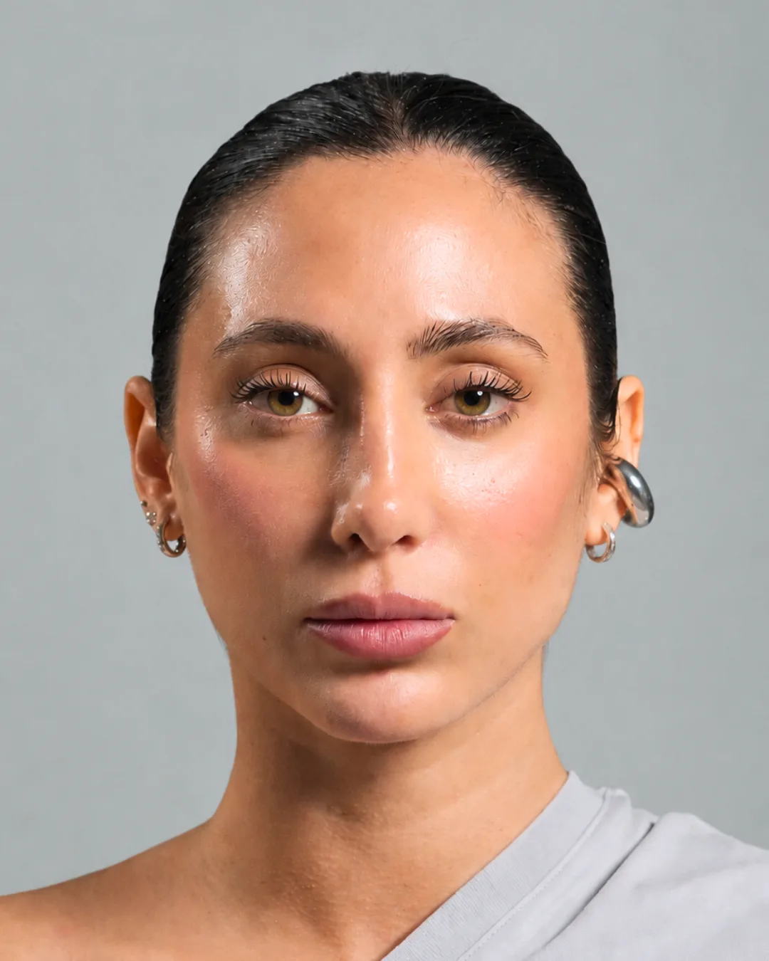 Paziente FaceLine® , dopo il protocollo